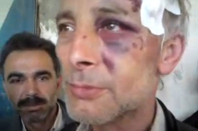 Torture in Syrian prisons