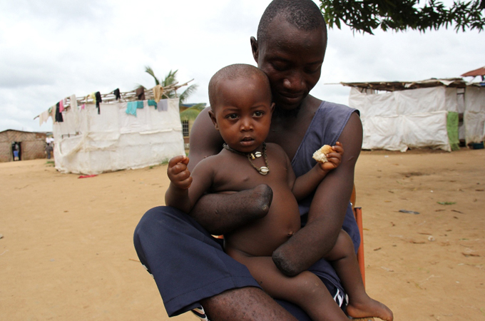 Mohamed Tarawallie, a victim of the RUF''s amputations and targeting of civilians. Travis Lupick photo.
