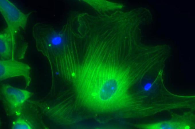 A microscopic view shows smooth muscle cells derived from human embryonic stem cells