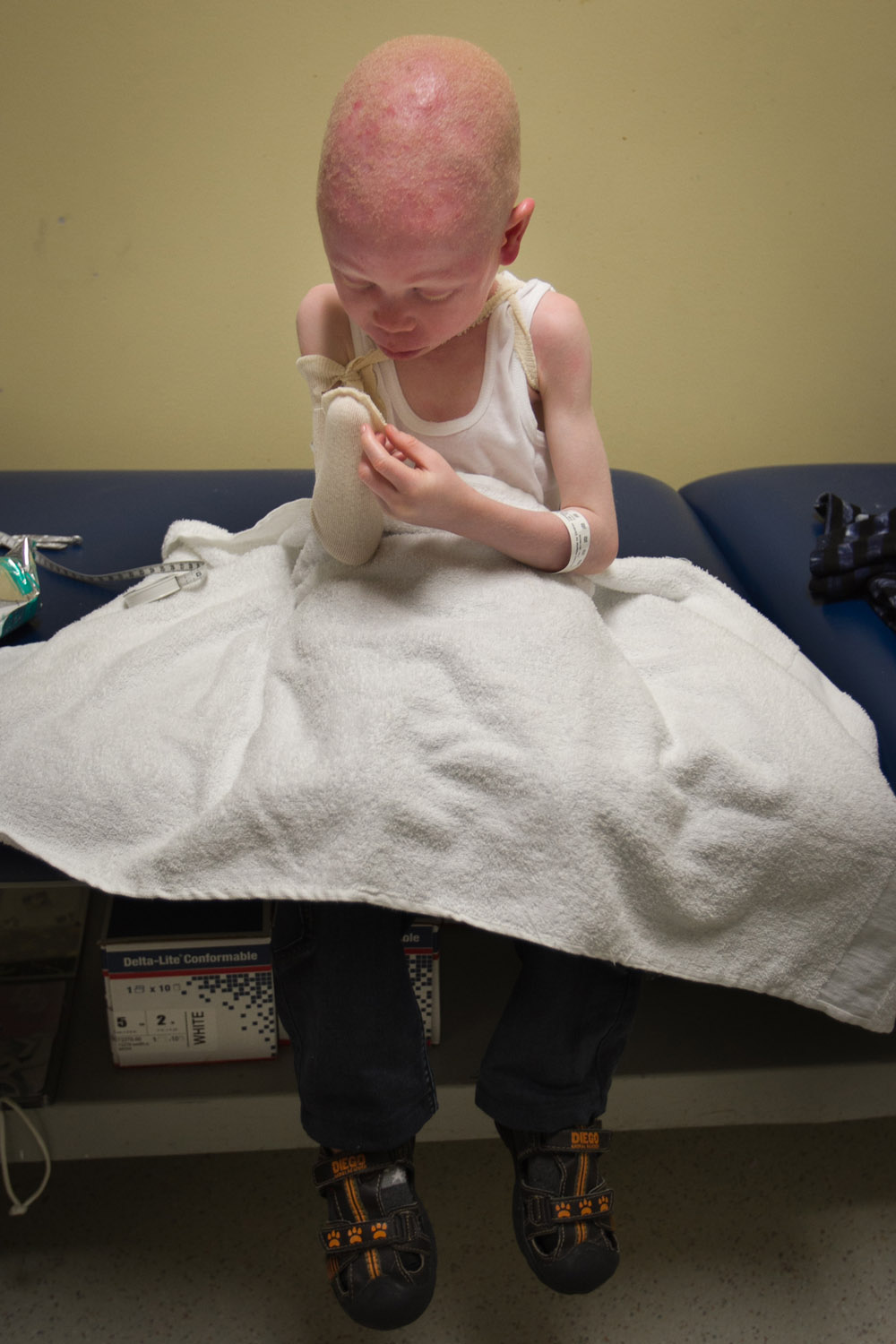 People born with albinism in Tanzania are often targeted by withchdoctors who use their body parts for their 'healing' activities [Alejandro A Alvarez/AP]