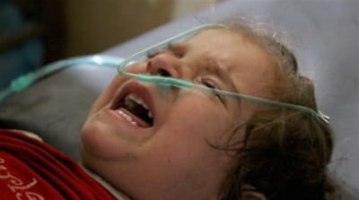 A wounded girl is treated at hospital in Ein Tarma district of Damascus, Syria [Getty] 