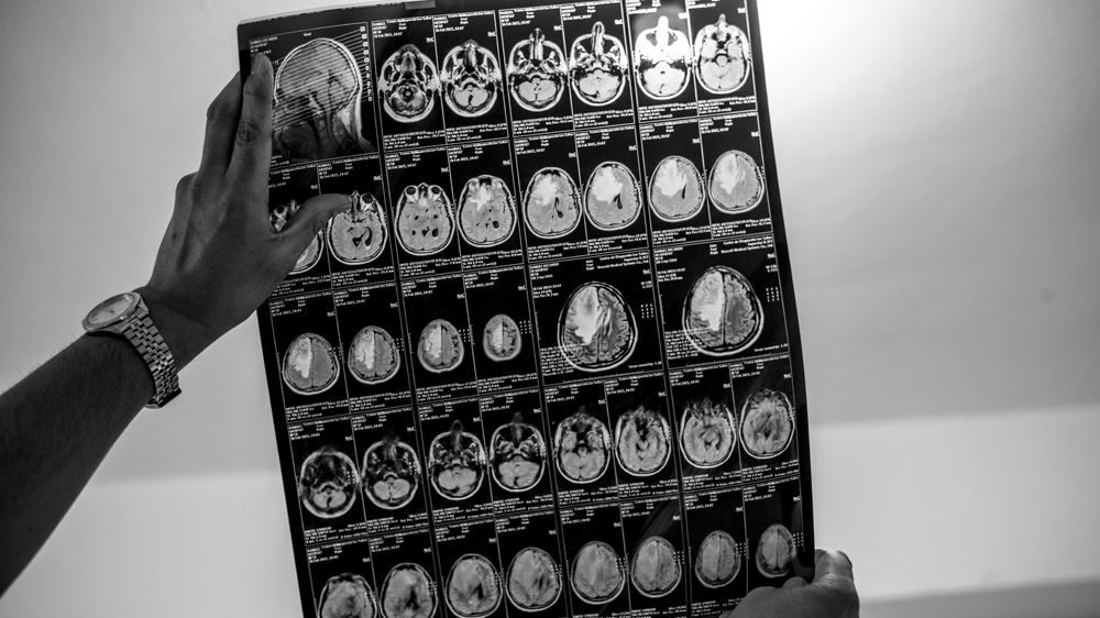 Doctors claim the brain tumour was a reappearance of a previous tumour [Alejandro Cegarra] 