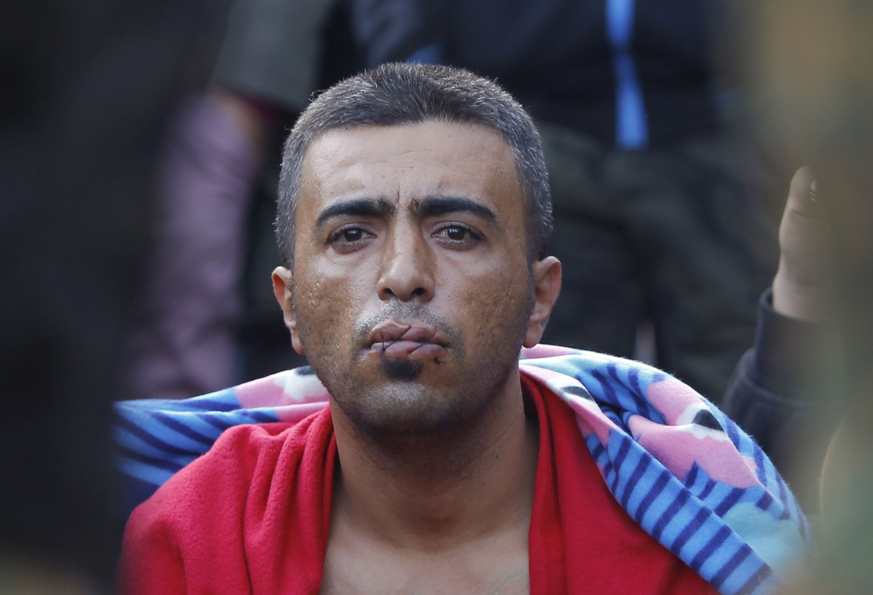 Refugees sew lips in Greece-Macedonia border protest