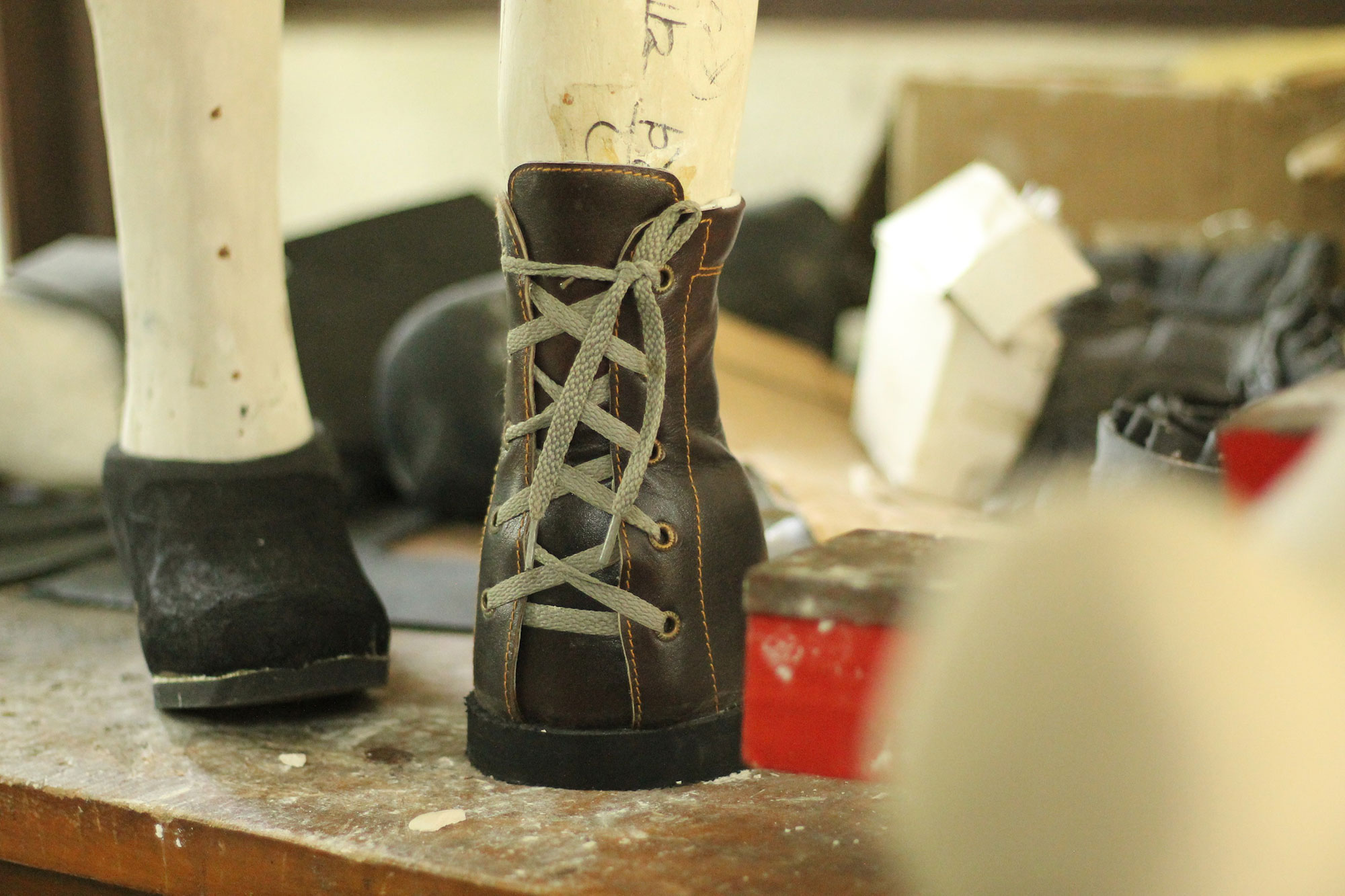 LEPROSY, Nepal/ Please Do Not Use