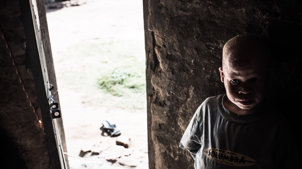 Semuju stays inside the house in the middle of the day, when the sun is blazing outside. Without sun cream or a hat, his skin begins to suffer within minutes [Fredrik Lerneryd/Al Jazeera]