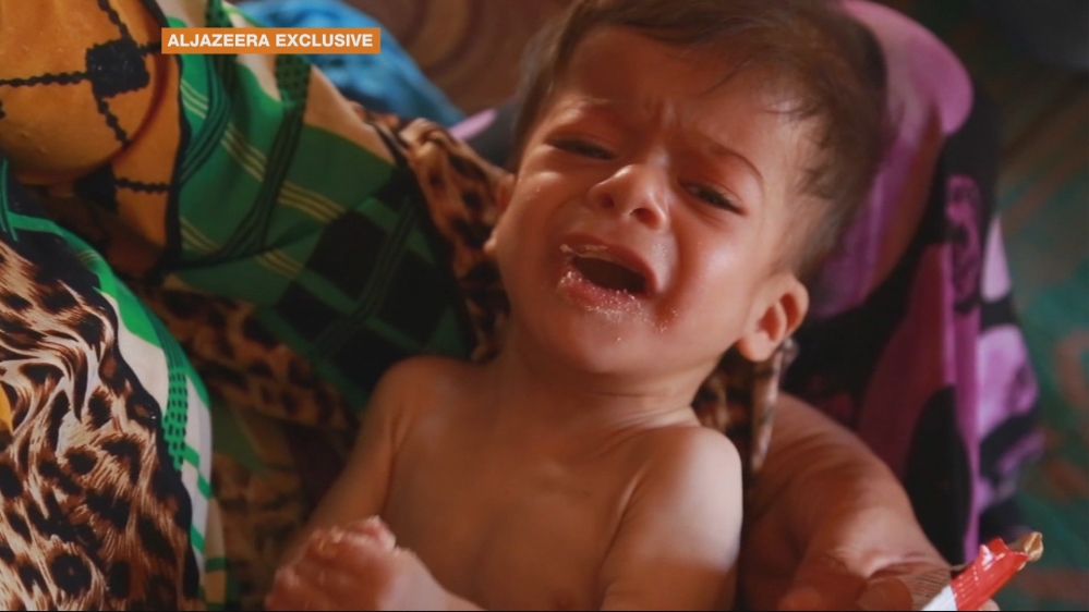 Children face malnutrition in Syria''s Hama amid war