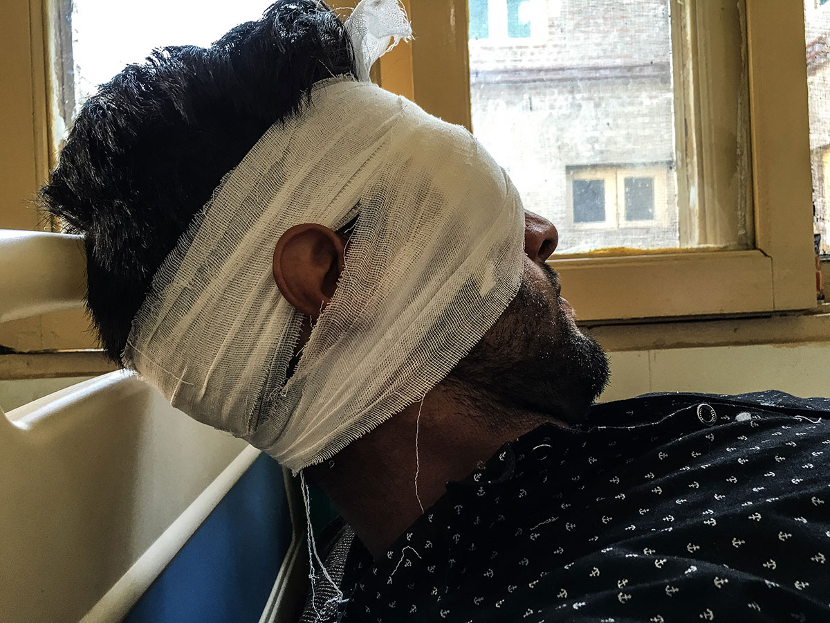 Pellet Injuries/ Please Do Not Use 