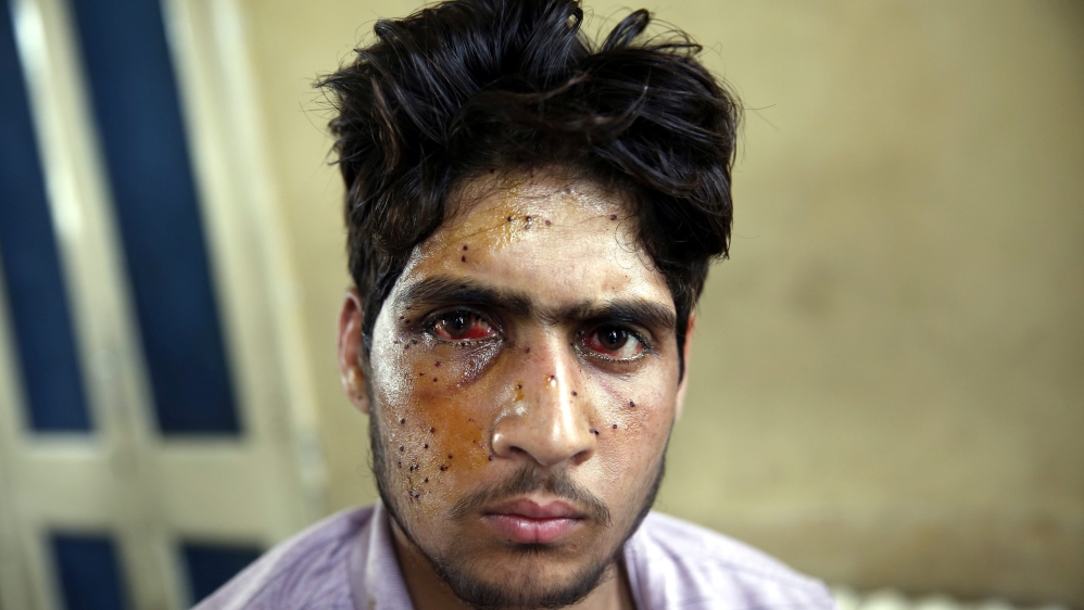 Pellet injuries in Indian Kashmir
