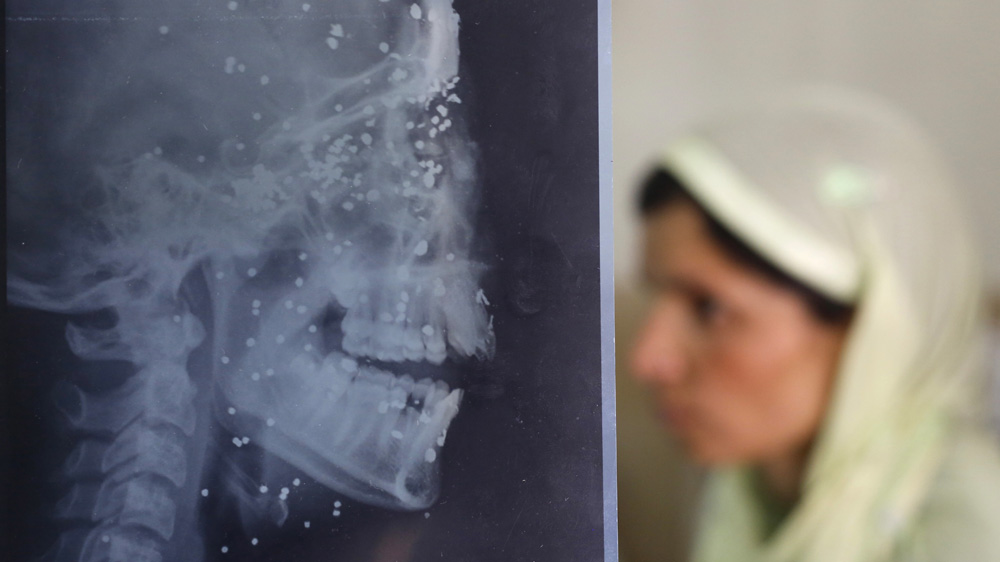 Fourteen-year-old Insha Malik was hit by pellets when she had looked through a window of her parents' home [AP] 