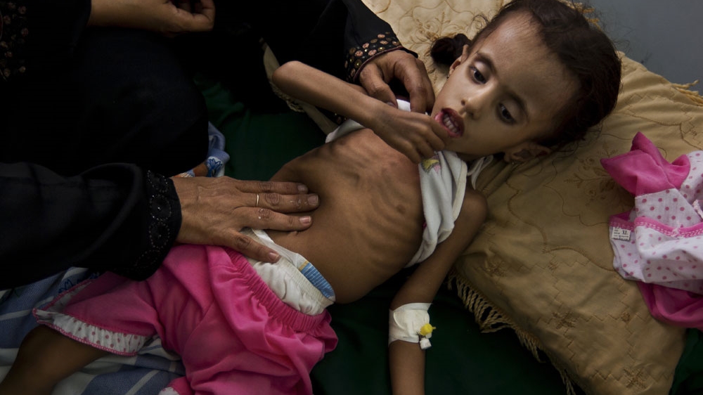 Malnutrition -Yemen