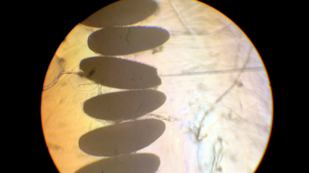 Under the microscope, scientists take the mosquito eggs and microinject the OX513A gene. A small needle pierces the outside of the egg without causing any lasting damage, allowing the male mosquitoes to hatch and carry the kill-switch gene [Al Jazeera]