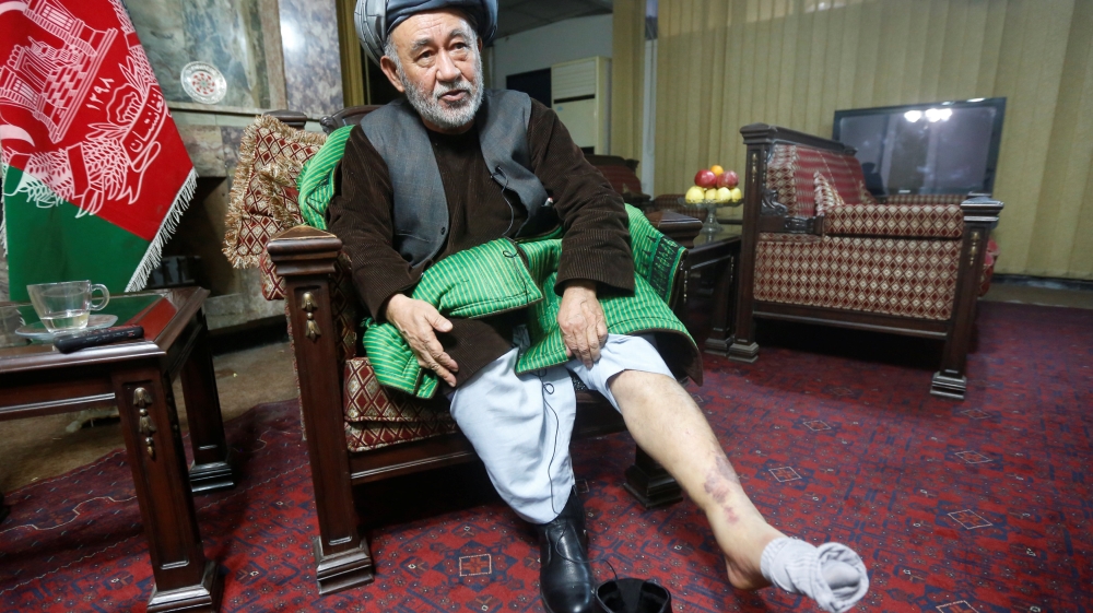 Ahmad Ishchi, who is reported to have been beaten and detained by AfghanistanÕs vice president Abdul Rashid Dostum last month, displays an injury on his leg during an interview at his home in Kabul