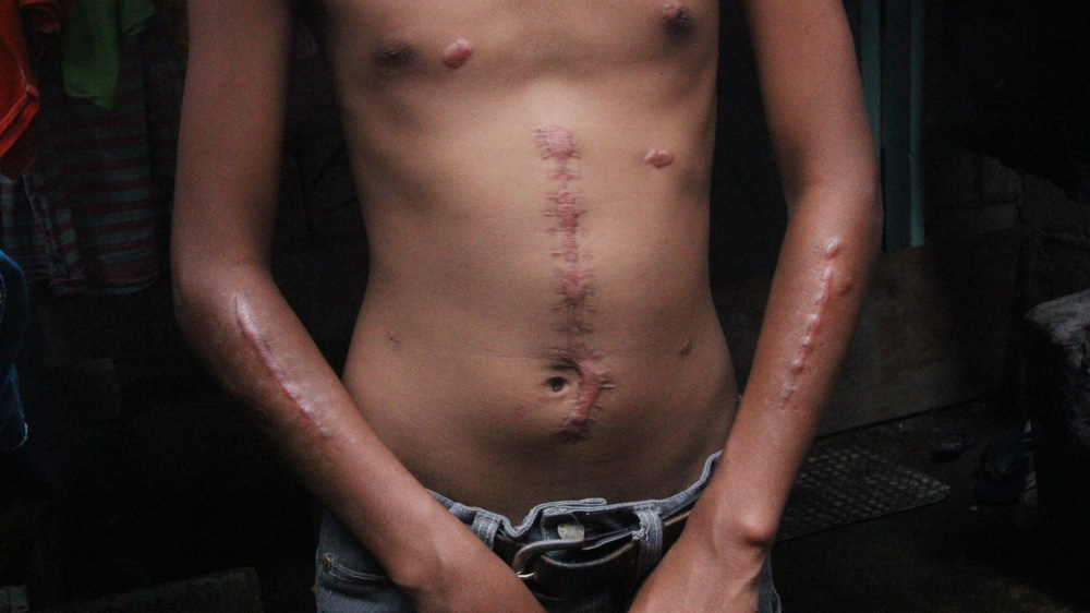 Philippines drug war