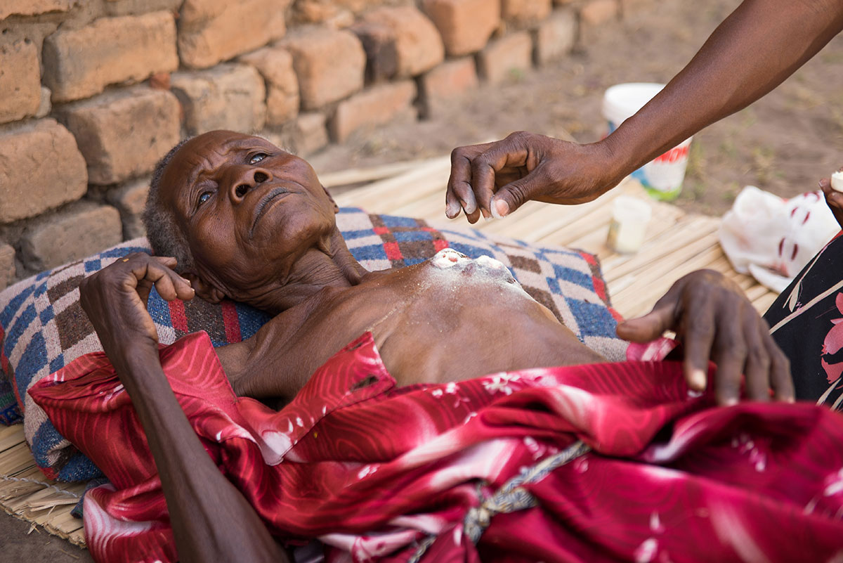 Cancer is a death sentence in Uganda/ Please Do Not Use