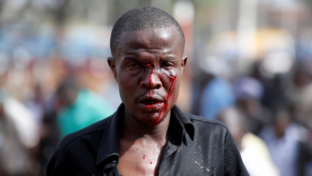 An injured supporter of Kenyan opposition National Super Alliance (NASA) coalition walks after he clams he was stabbed during clashes in Nairobi