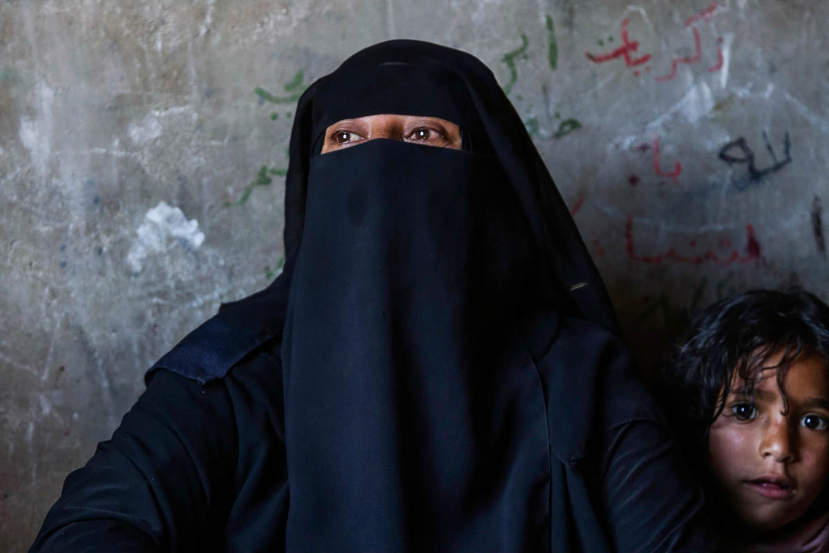 Wedad is a single mother with four children from Amran. The dramatic hunger and poverty she has been pushed into make her prefer to die. “I pray God, please let us die or solve this, or let us die si