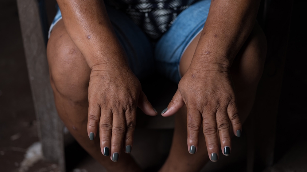 Of the 10 most dangerous countries, seven are in Latin America [Thom Pierce/Guardian/Global Witness/UN Environment] 