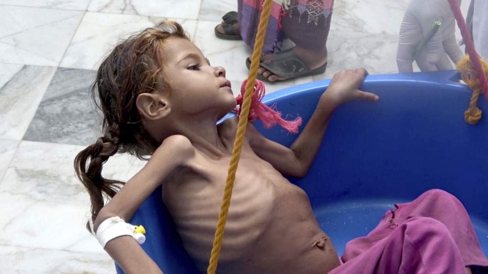 Yemen famine