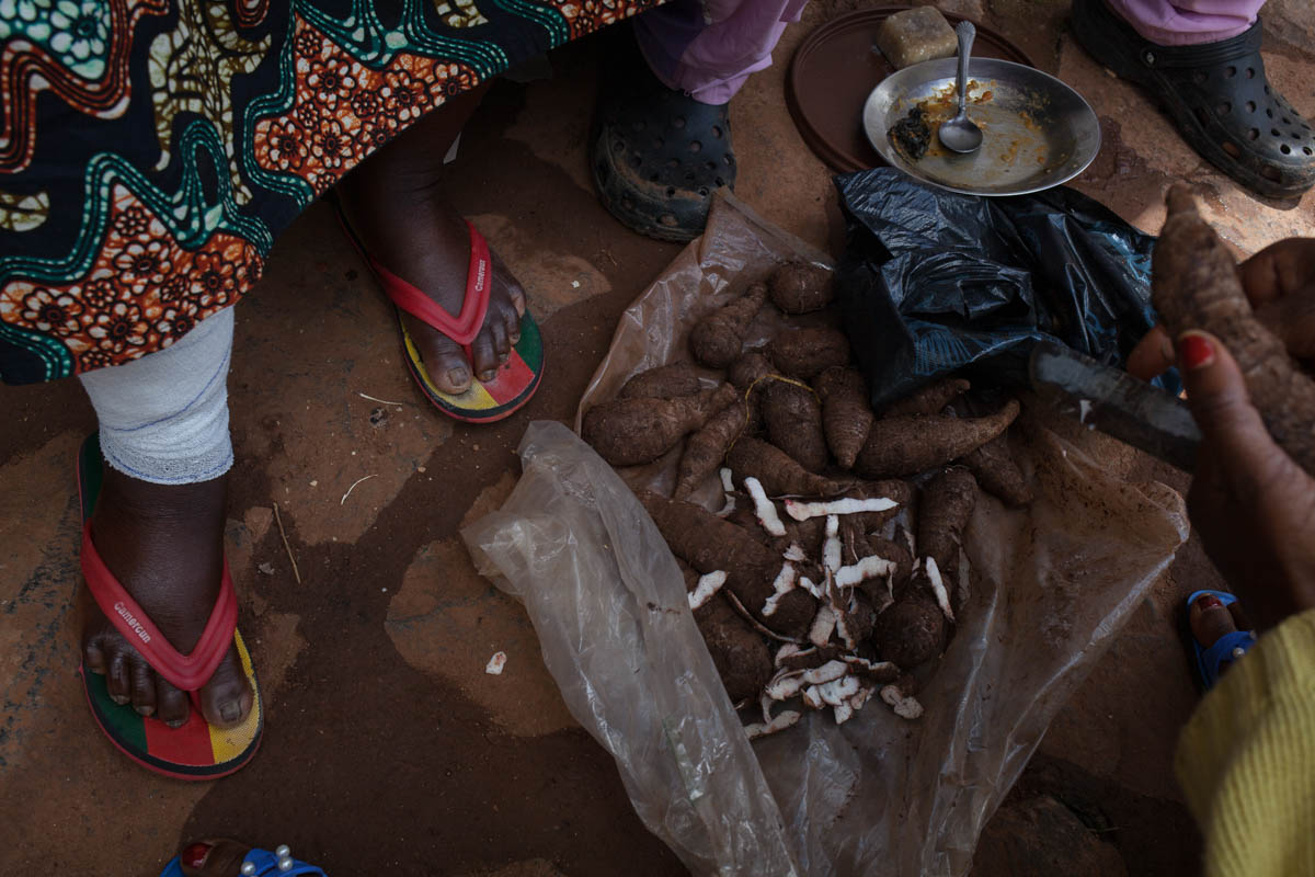 Julienne Nopoudem, 75, sitting next to her daughter Adèle, who prepares macabo. Julienne has a wound that''s been coming back since she was 10 years old. She has been successfully treated four times, b