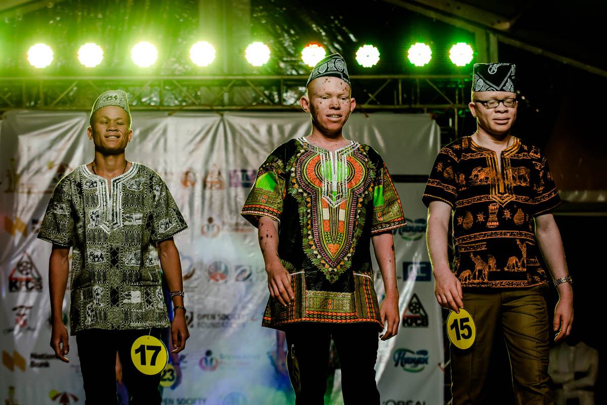 East Africa albino beauty pageant aims to fight social stigma