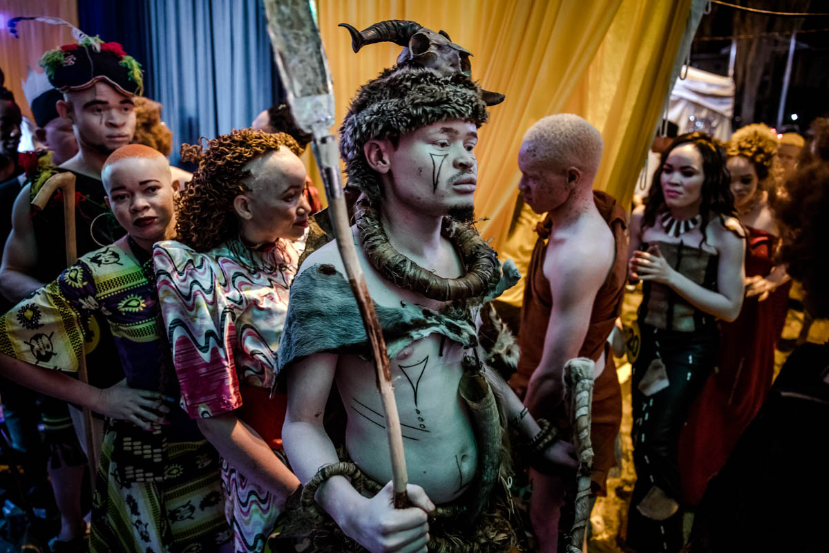 East Africa albino beauty pageant aims to fight social stigma