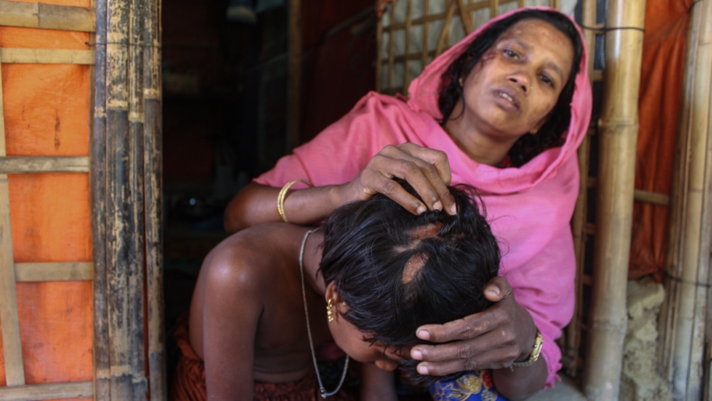 Mamtaj shows injuries sustained by her daughter Rajia, seven, during the crackdown. At the Kutupalong-Balukhali camp [Ayesha Akter/Al Jazeera]