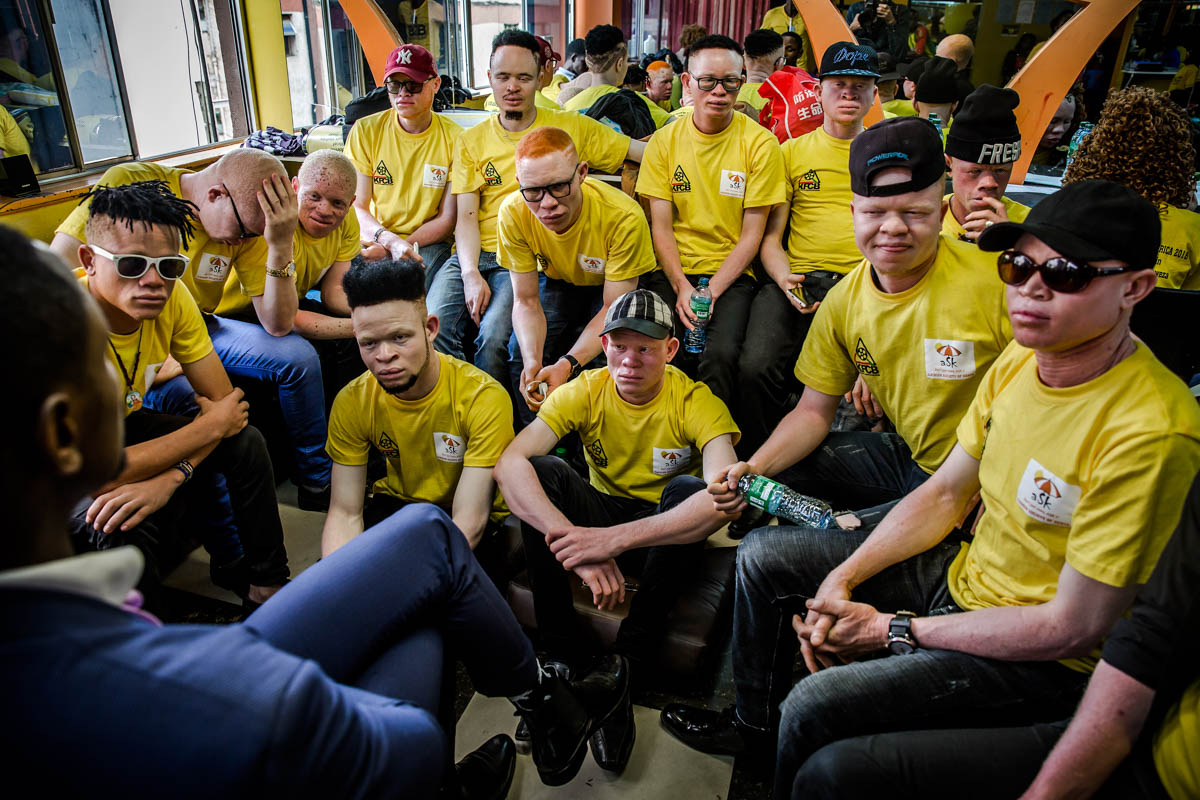 East Africa albino beauty pageant aims to fight social stigma