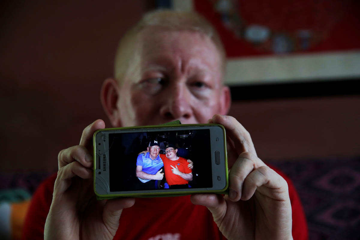 Graphic designer Armando Silos, aged 55, shows a picture of him and his albino friend, at his house in the Panama Oeste province, Panama, 23 June 2019. The indigenous Guna people, one of seven ethnic