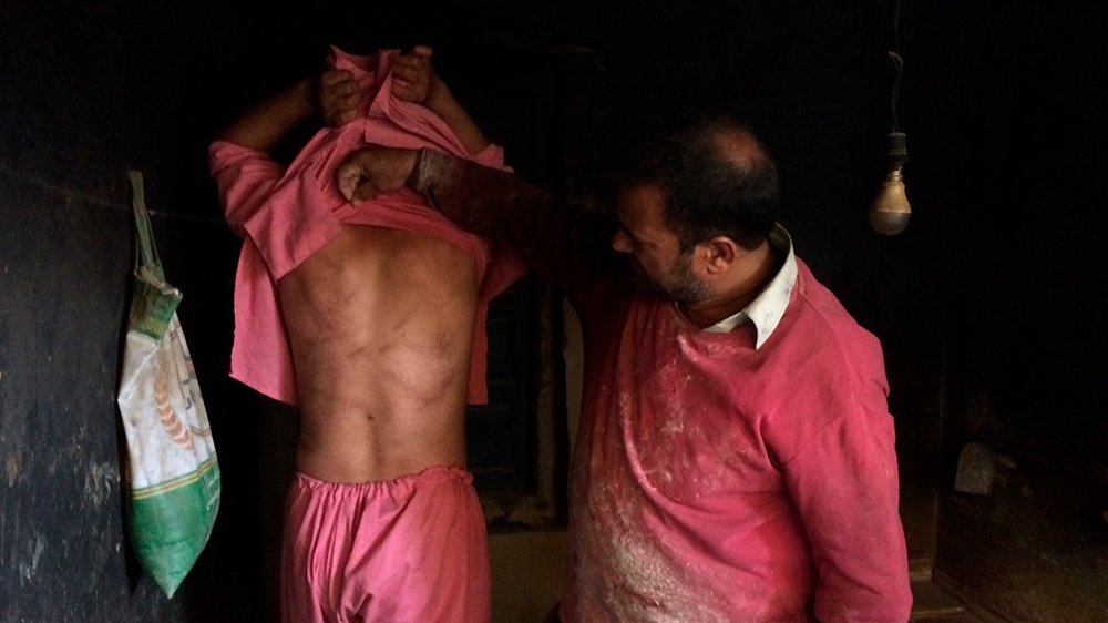 In this Monday, Aug. 26, 2019, photo, a Kashmiri baker Sonaullah Sofi lifts the shirt from his son''s back to show torture marks allegedly caused by Indian army soldiers at their bakery in southern vil