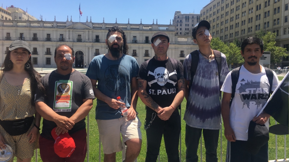 argentina eye protest