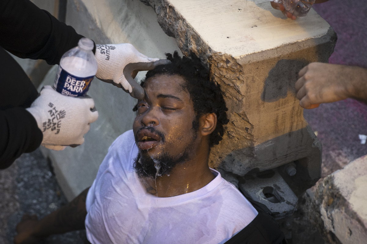 WASHINGTON, DC - JUNE 22: A man is tended to after being hit with pepper spray as protesters clash with U.S. Park Police after they attempted to pull down the statue of Andrew Jackson in Lafayette Squ