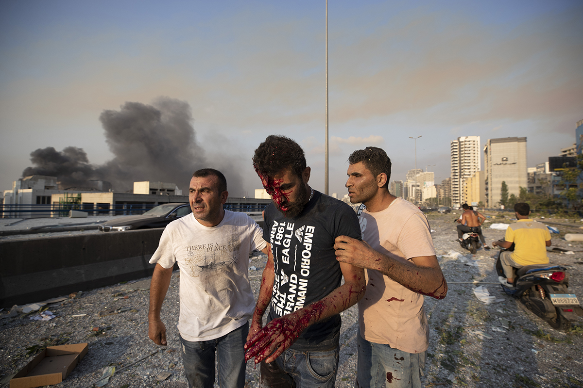 People help a man who was wounded in a massive explosion in Beirut, Lebanon, Tuesday, Aug. 4, 2020. Massive explosions rocked downtown Beirut on Tuesday, flattening much of the port, damaging building