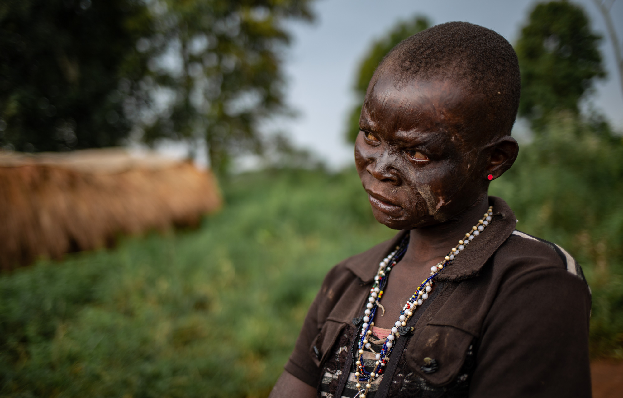 "They killed women, men and children. They burned more than 250 houses," Anne says. [Tom Peyre-Costa/NRC]