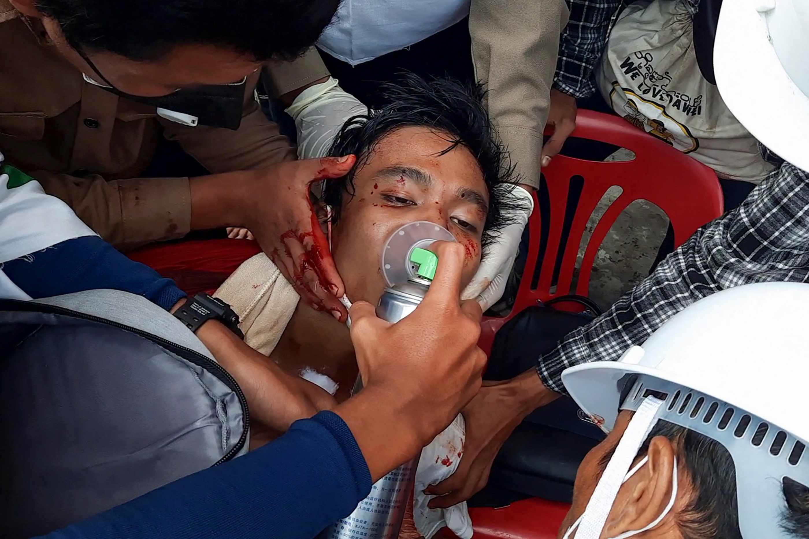 An injured man being treated by volunteer medical responders after a crackdown by security forces in Myanmar's southern city of Dawei on February 28. [Handout via AFP]