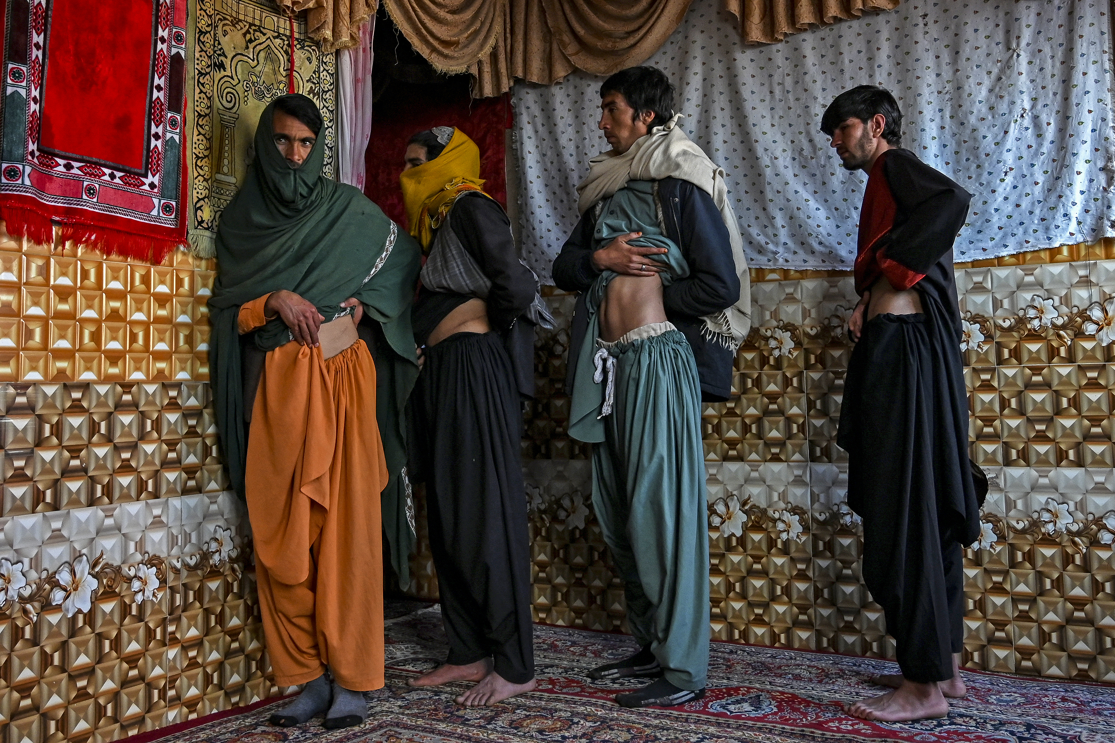 In this photo taken on February 4, 2022, Afghan men who sold their Kidney earlier in an attempt to save their family from starvation, shows the operation scars marks inside their house in Sayshanba Bazaar in the Injil district of Herat province. - Jobless, debt ridden, and struggling to feed his children, Nooruddin felt he had no choice but to sell a kidney -- one of a growing number of Afghans willing to sacrifice an organ to save their families. (Photo by Wakil KOHSAR / AFP)