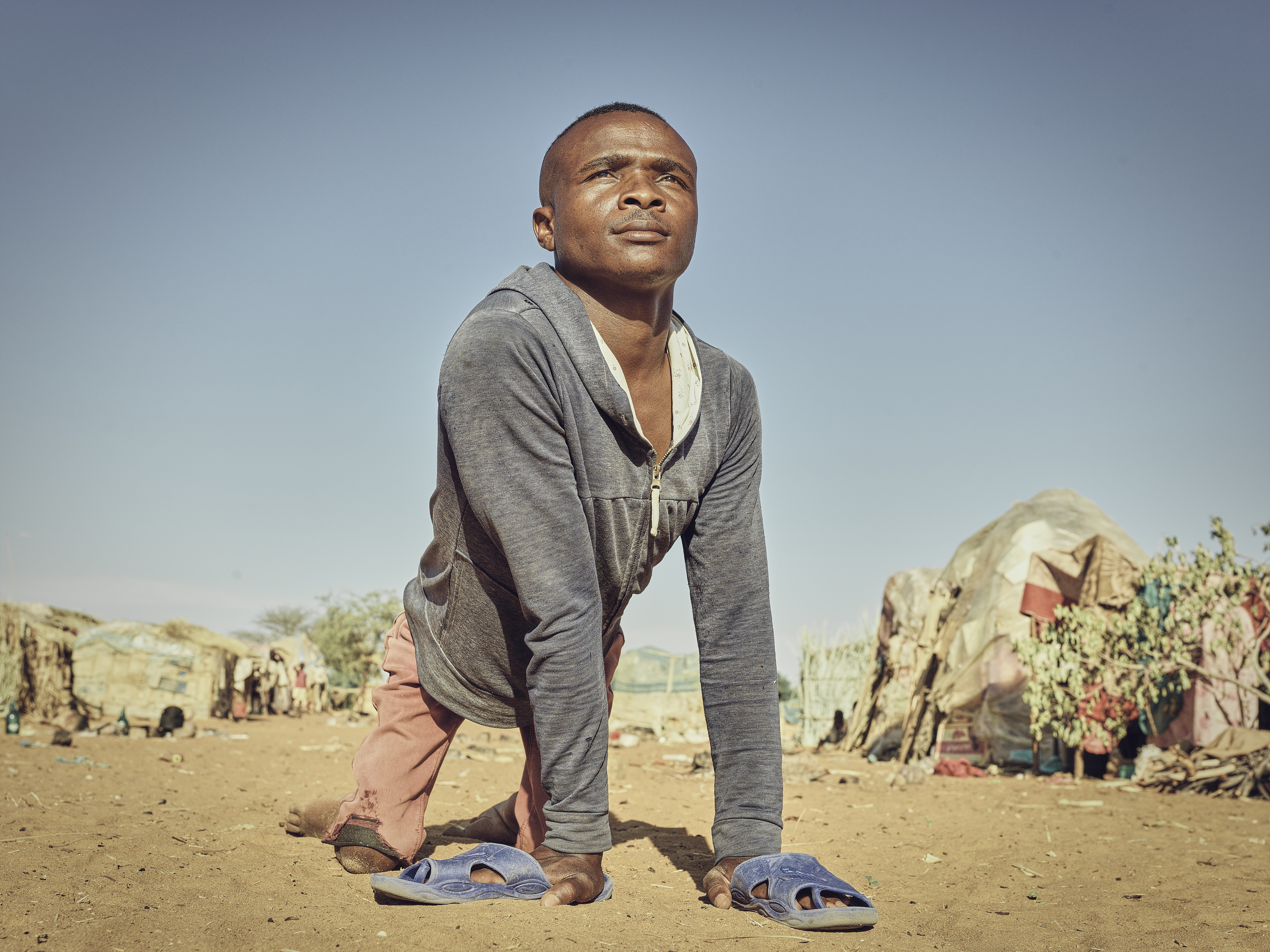 A disabled Angolan refugee with his hands on the ground, outside the refugee tents.