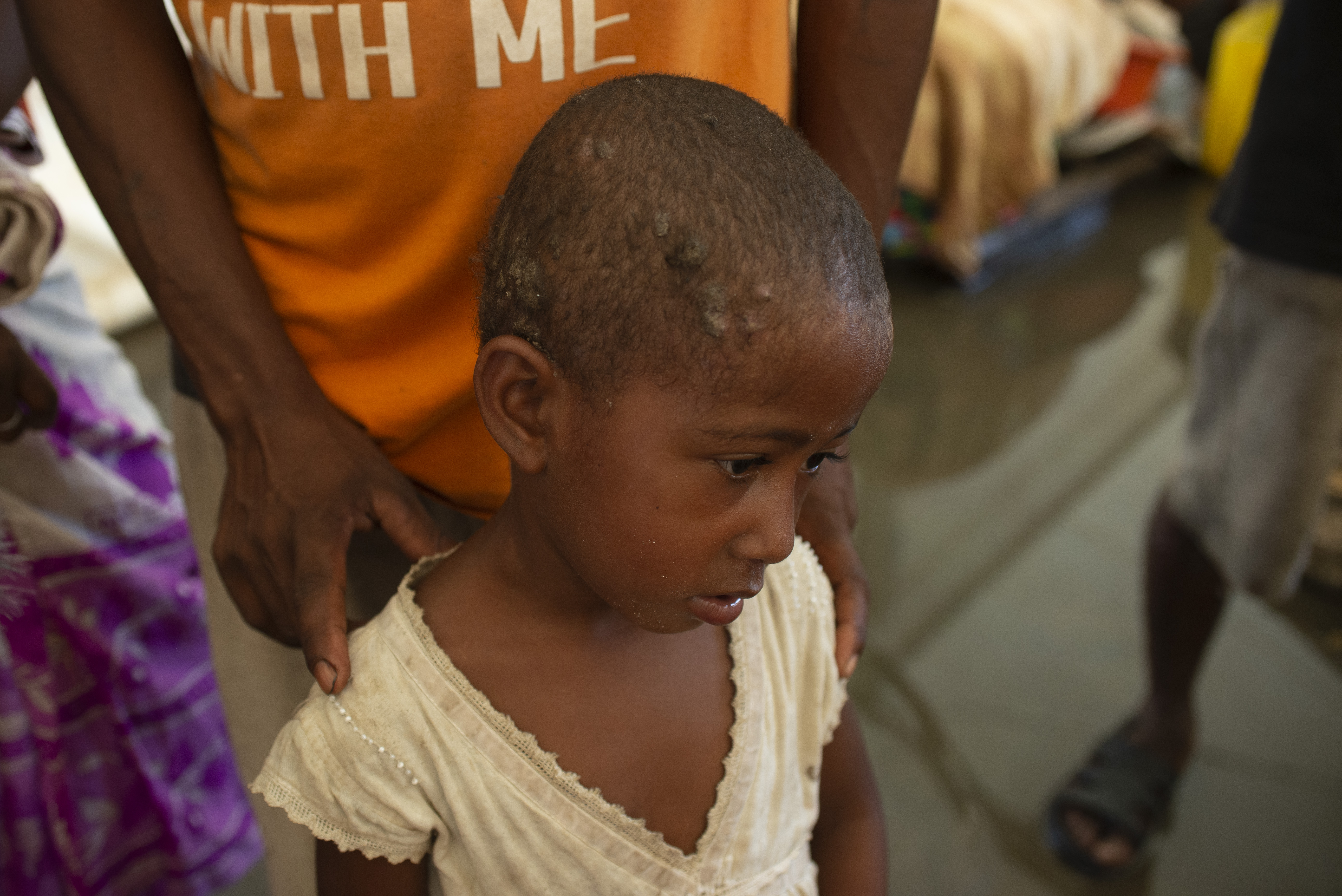 Madagascar cyclone recovery