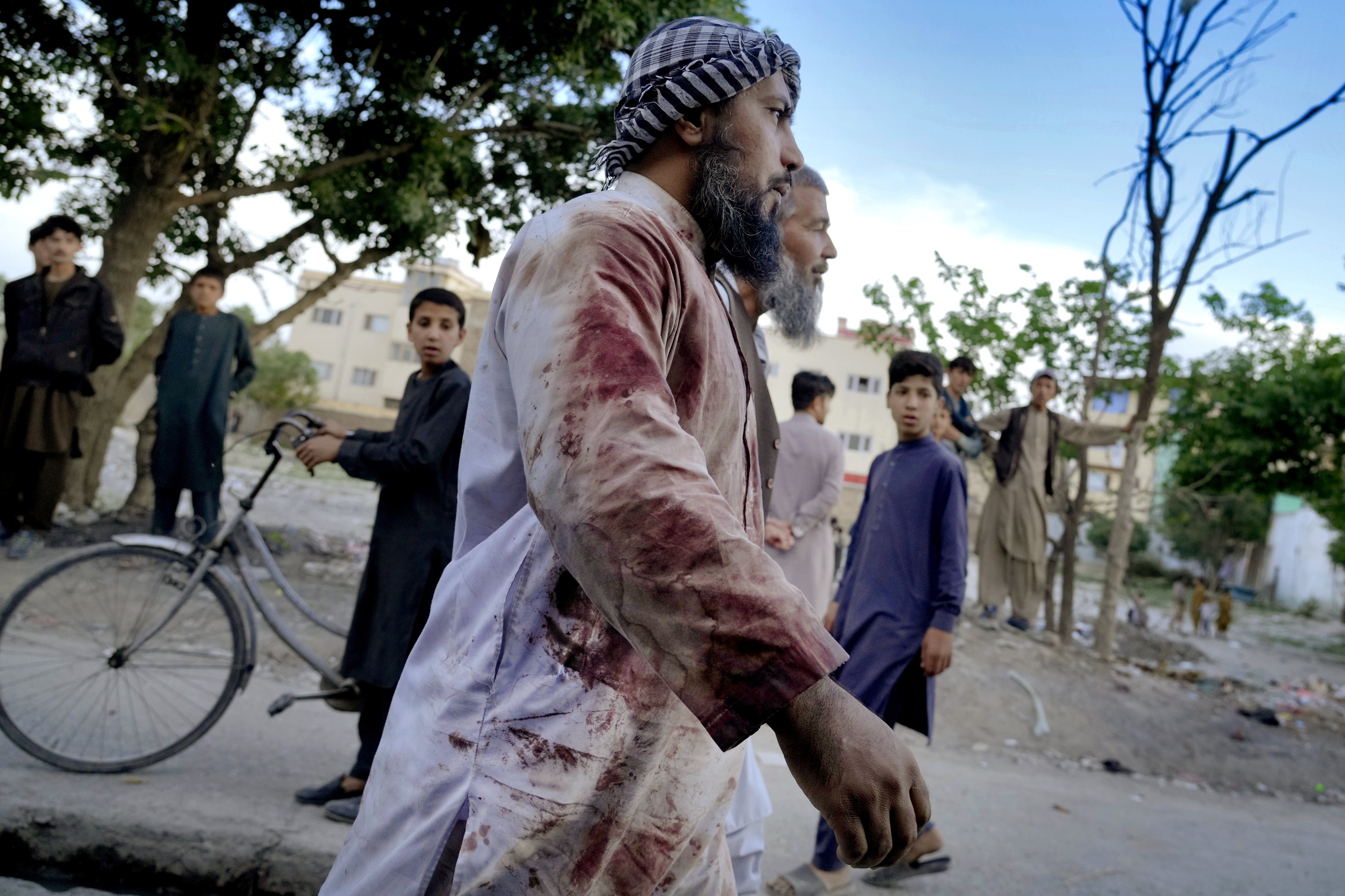 An Afghan blood-stained worshiper walks around the mosque where the explosion took place, in Kabul, Afghanistan, Friday, April 29, 2022.