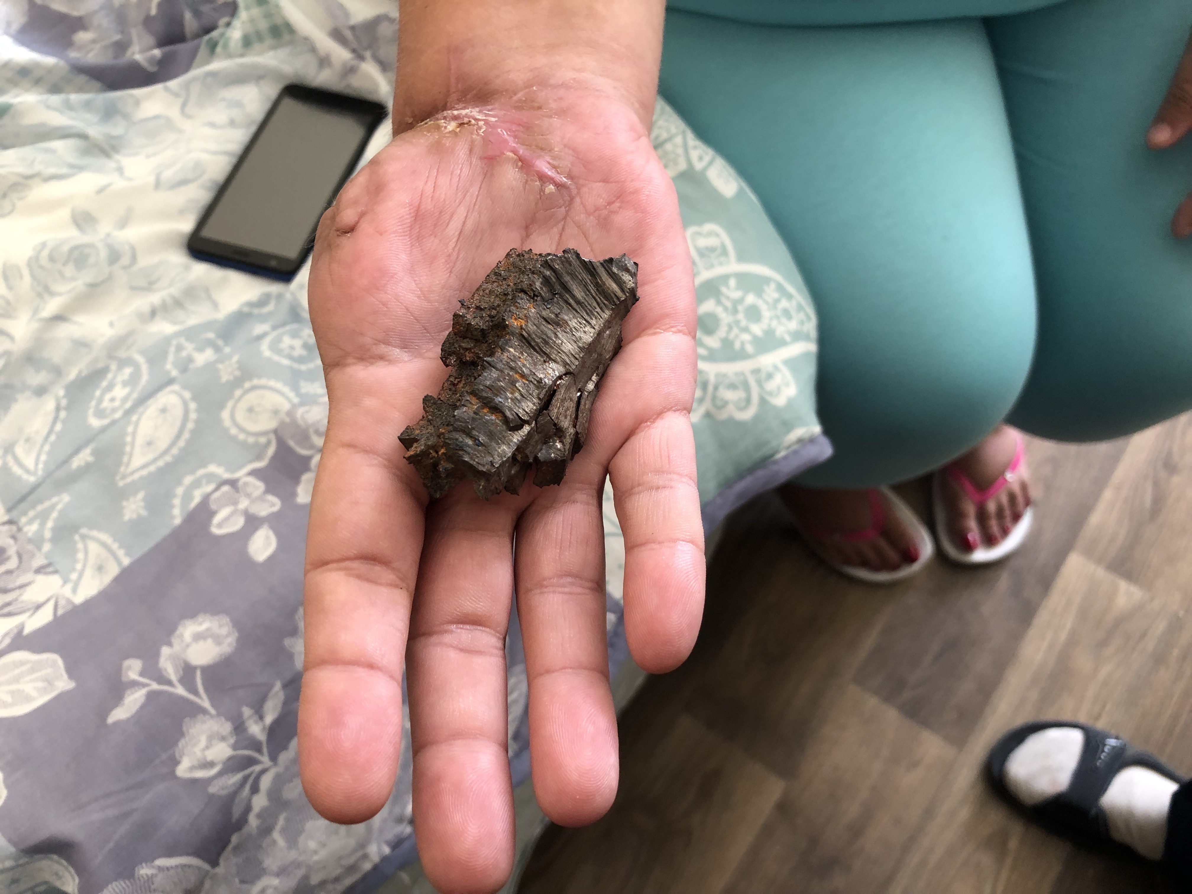 A photo of Iryna Vetrova holding a piece of shrapnel and her hand is missing a thumb.
