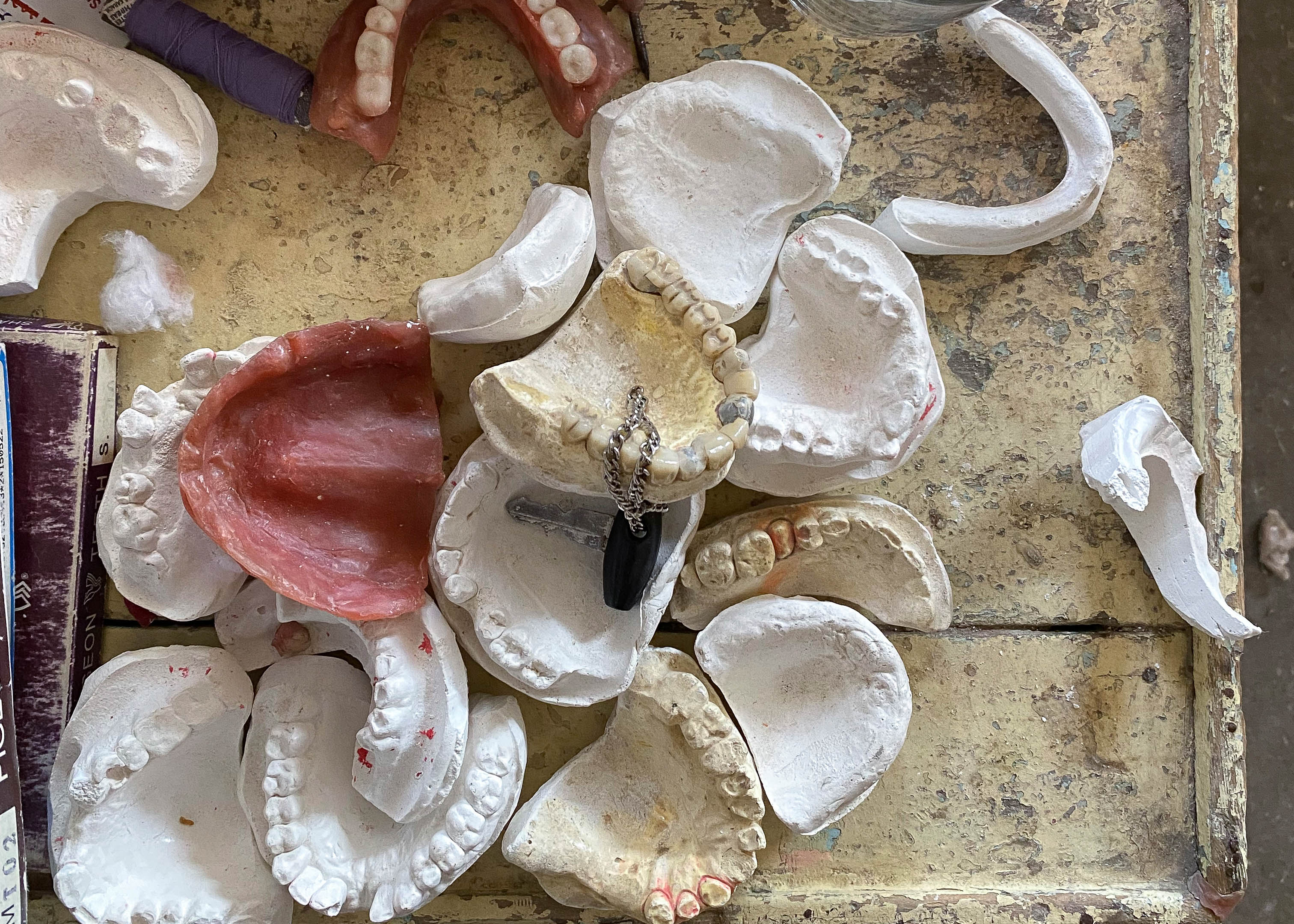 A photo of a table with dentures.