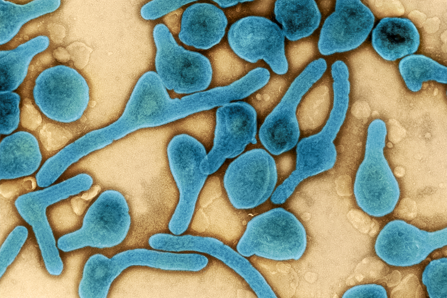 Marburg virus particles