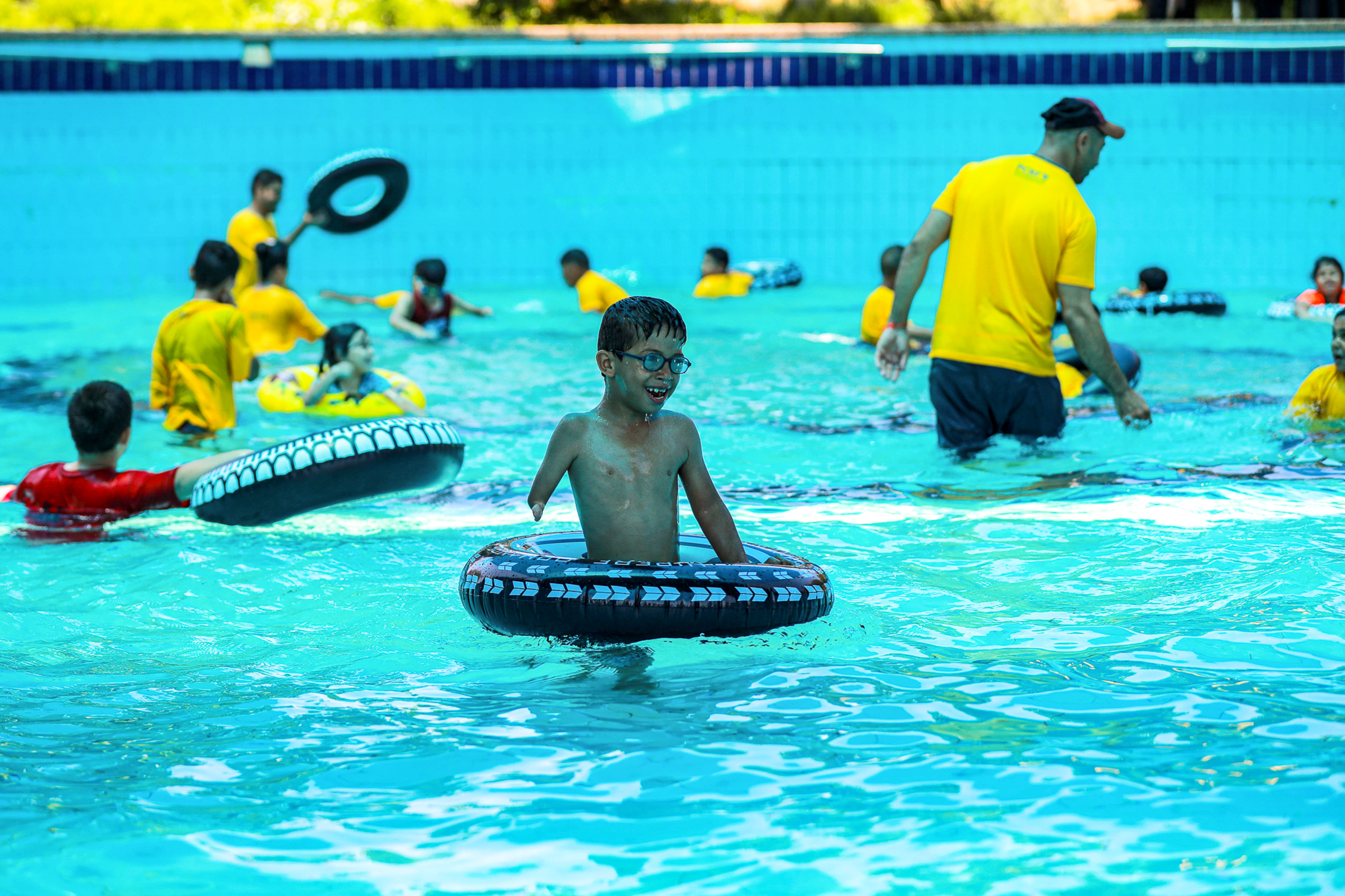 child amputees in Gaza