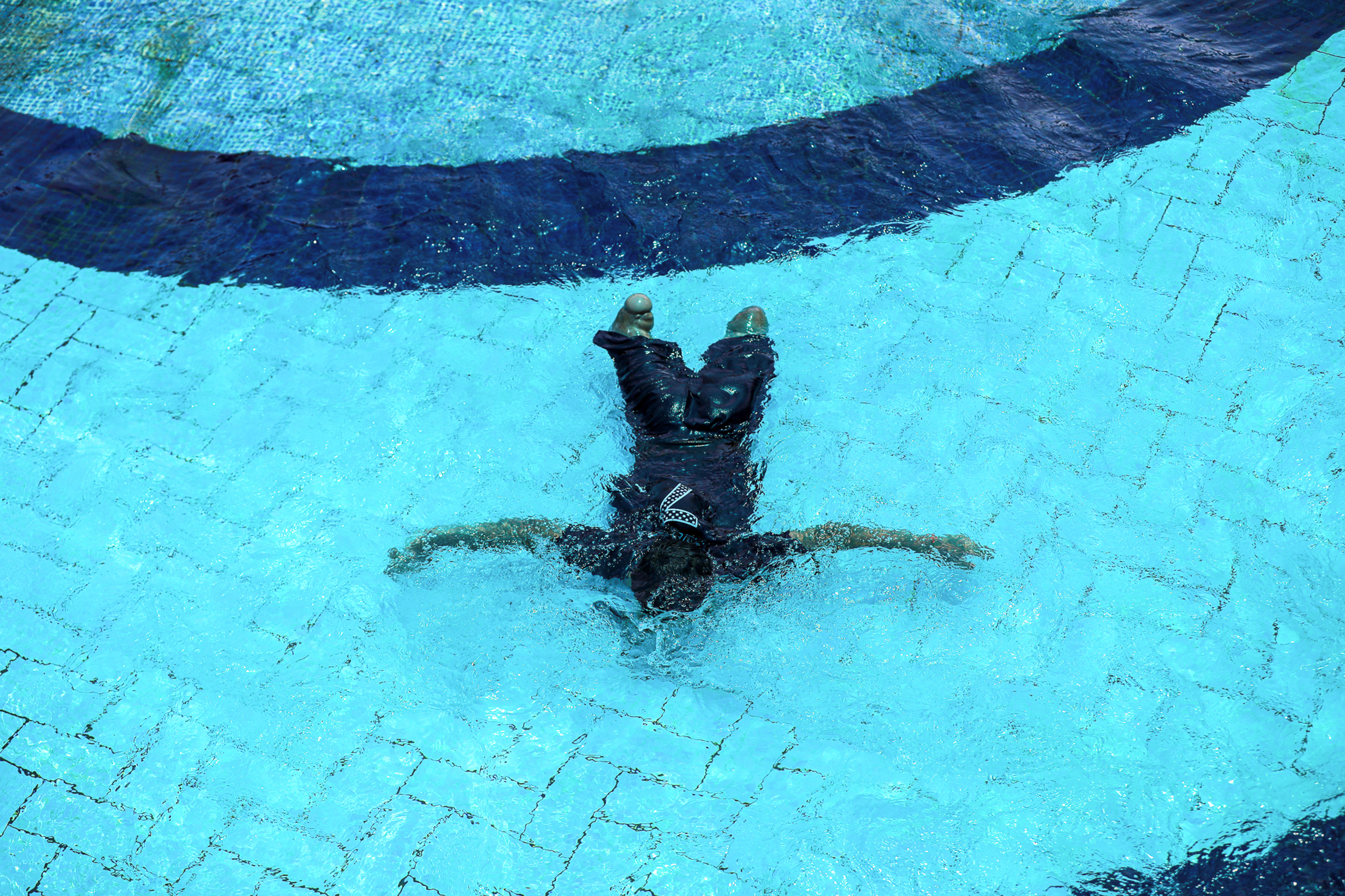 child amputees in Gaza