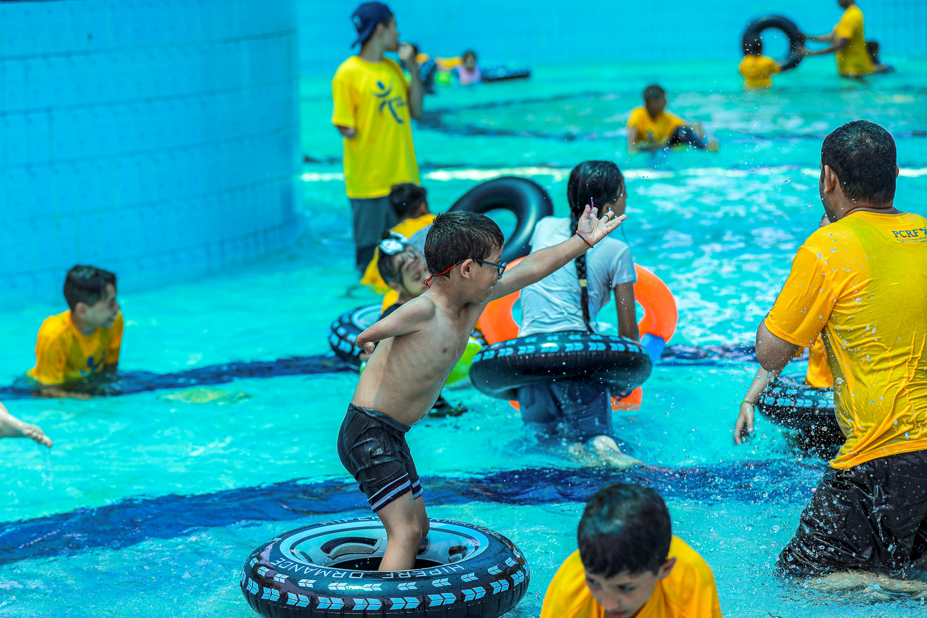 child amputees in Gaza