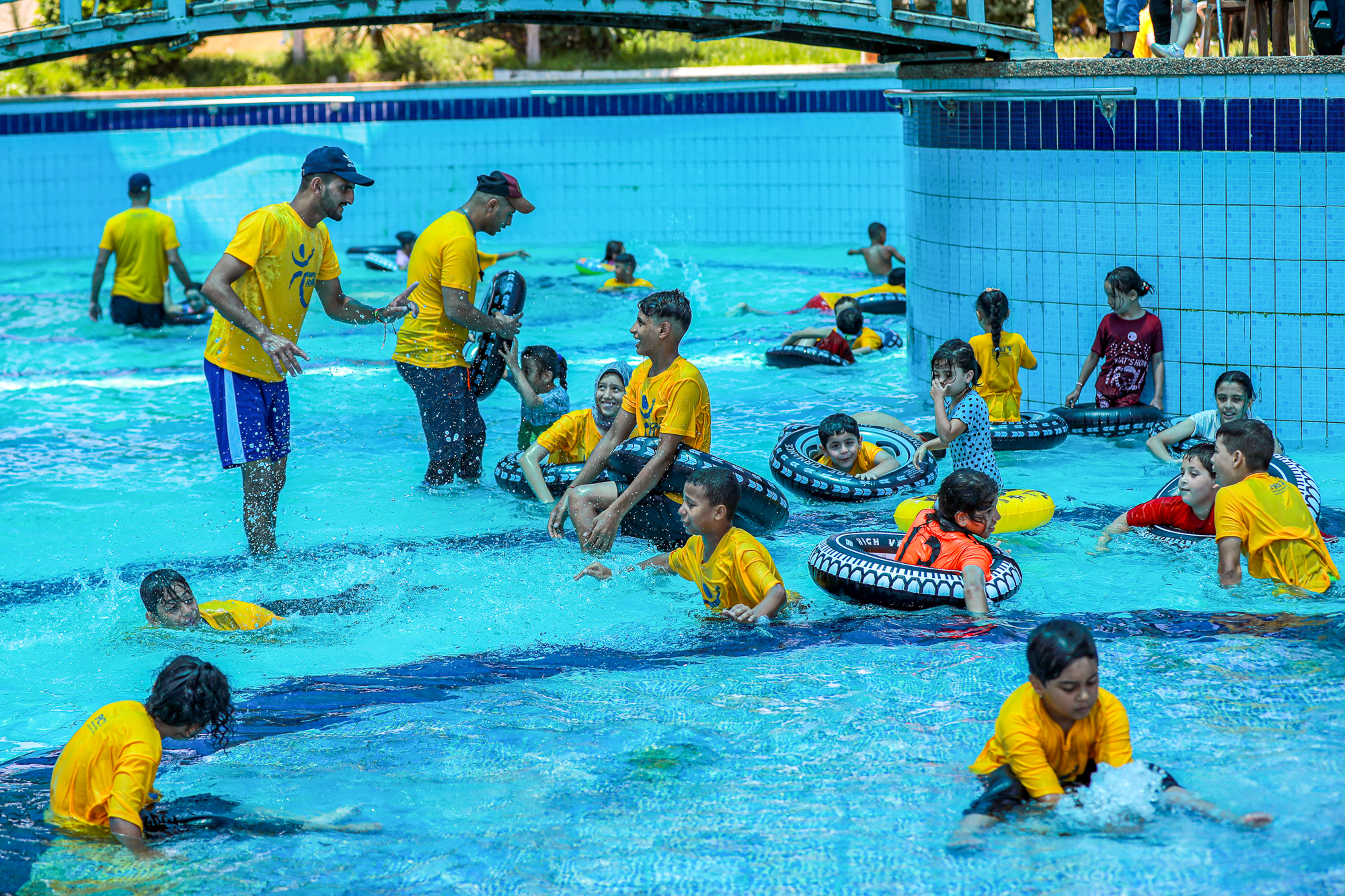 child amputees in Gaza