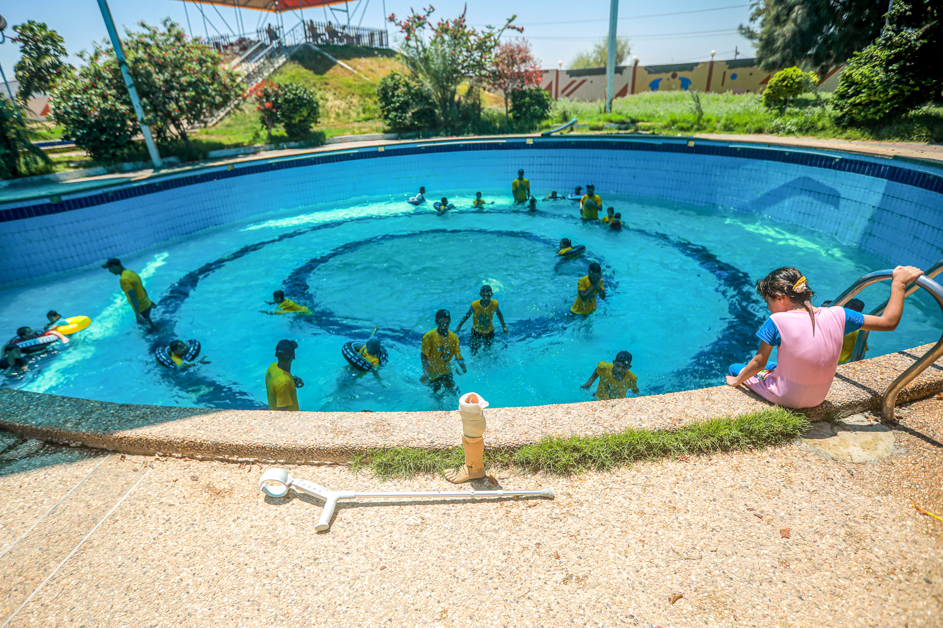 child amputees in Gaza
