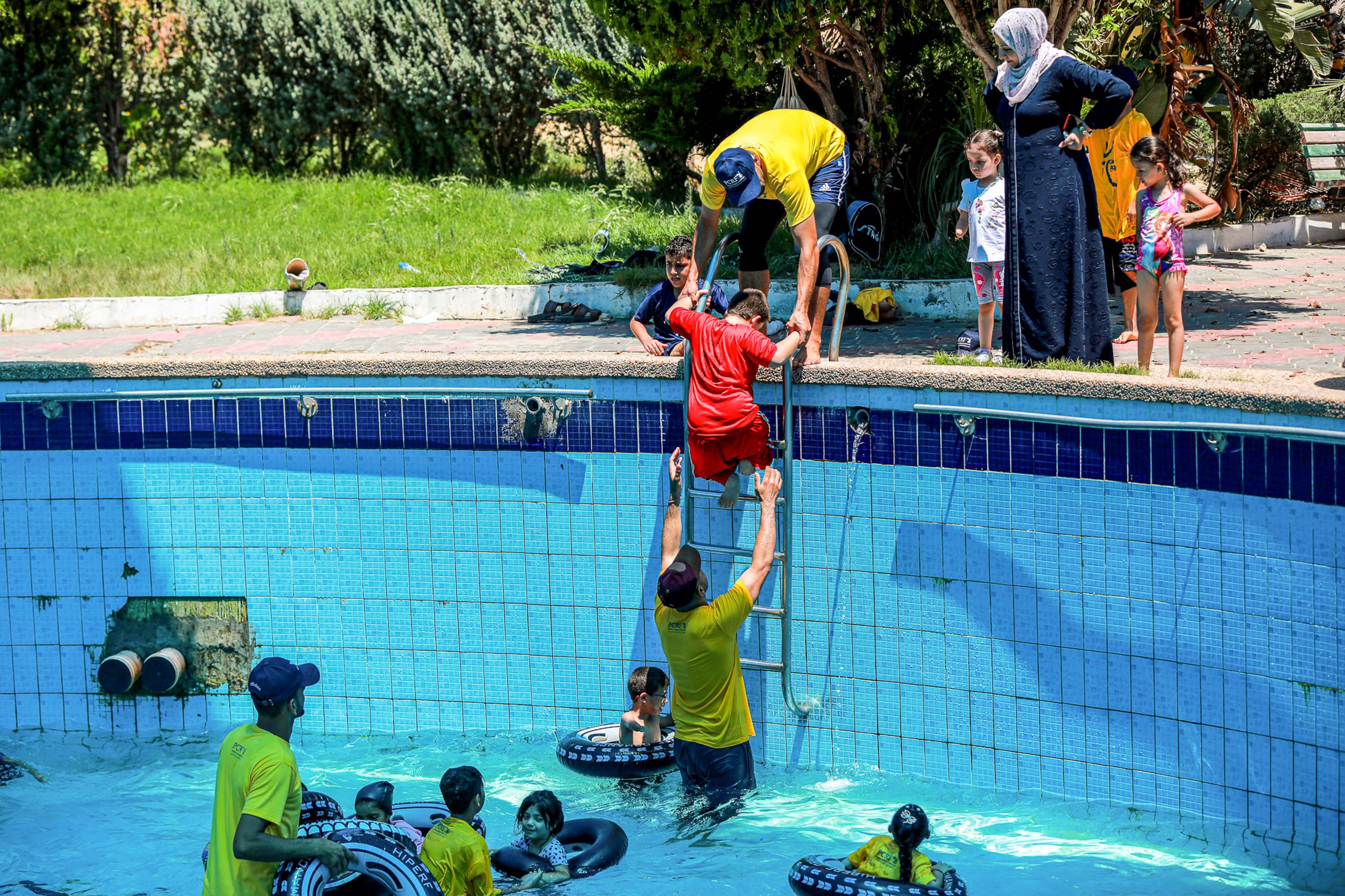 child amputees in Gaza