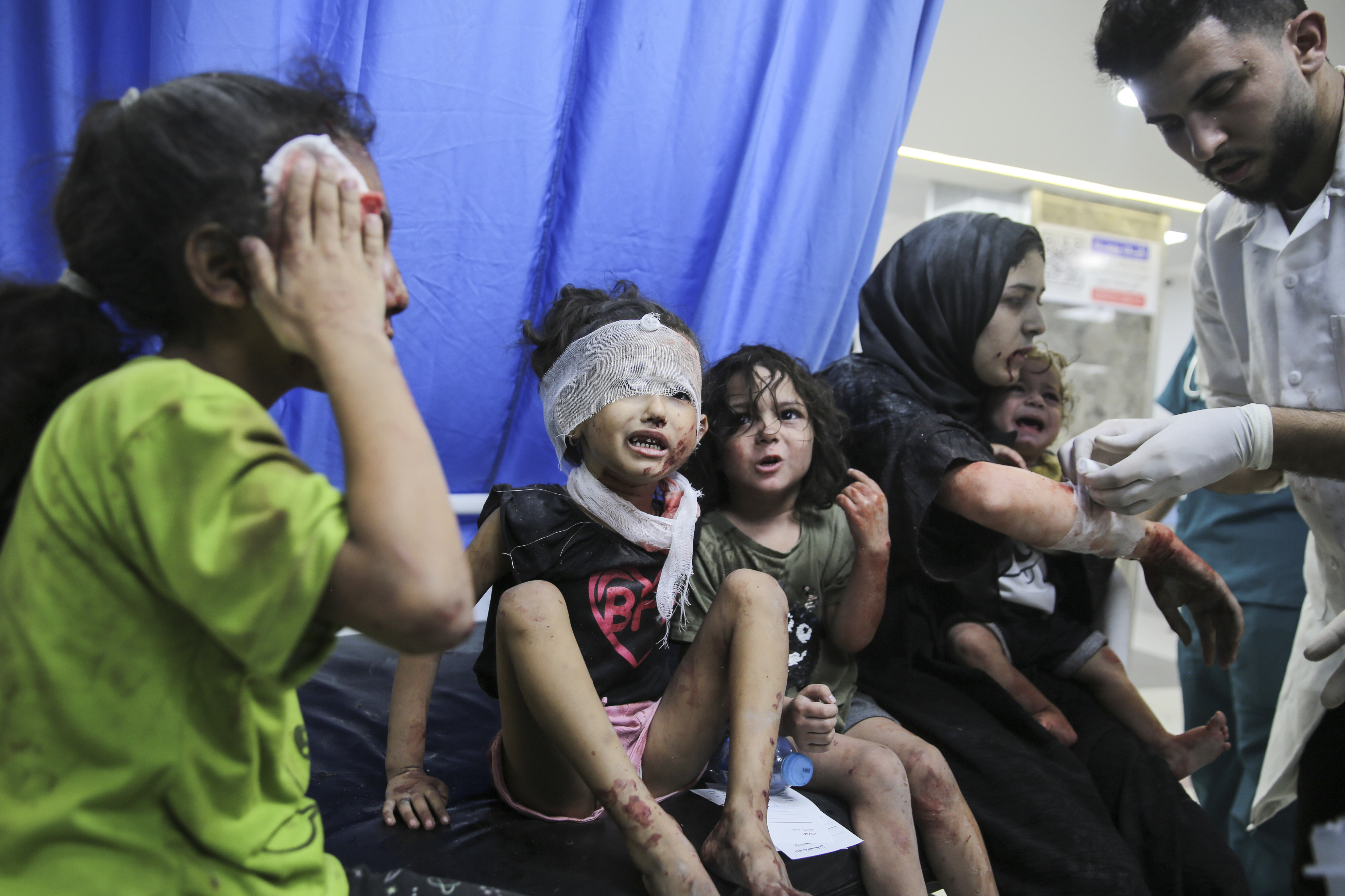Palestinian children wounded in Israeli strikes are brought to Shifa Hospital in Gaza City
