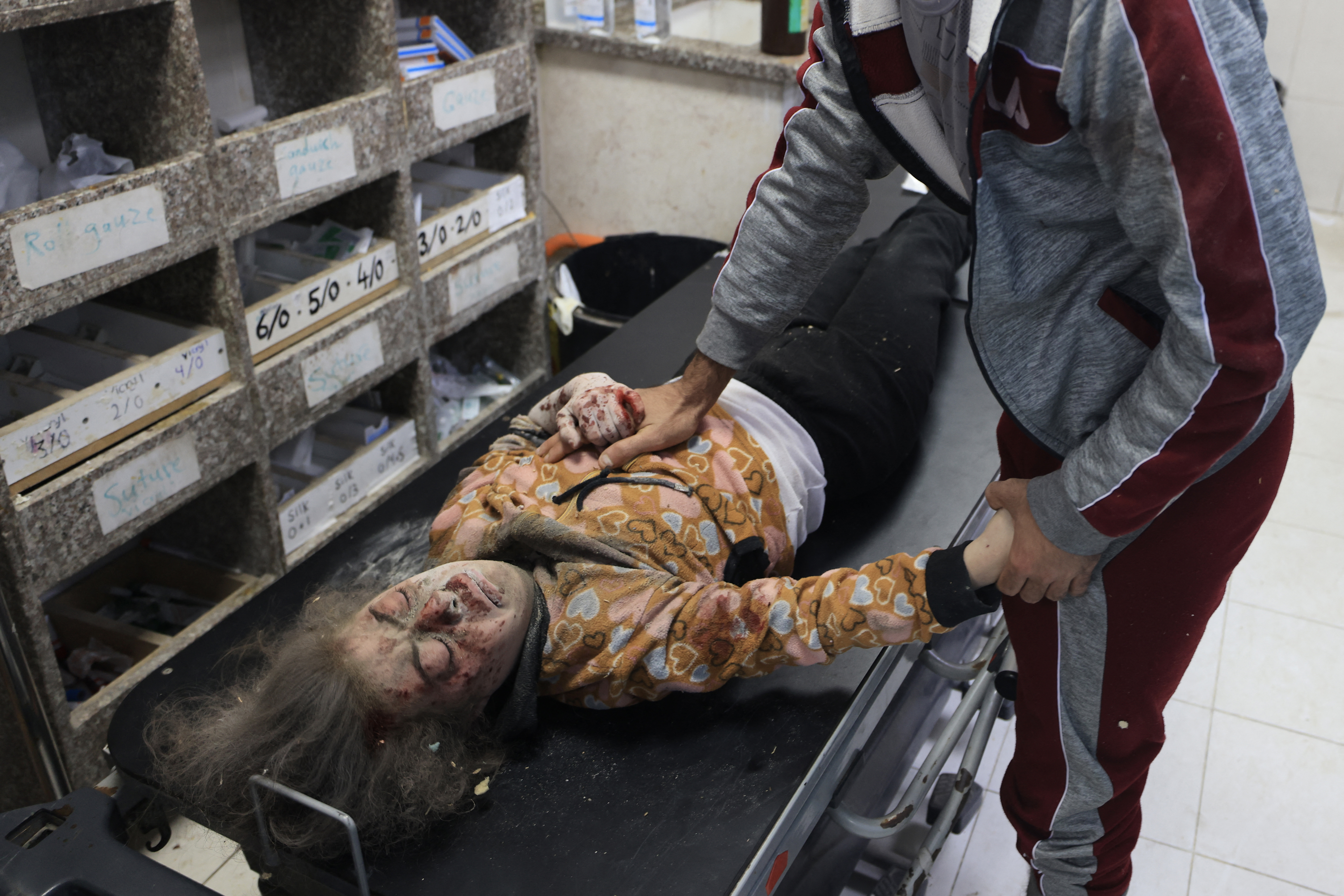 A man comforts an injured child after a house was hit by Israeli bombing in Khan Yunis in the southern Gaza Strip on December 3