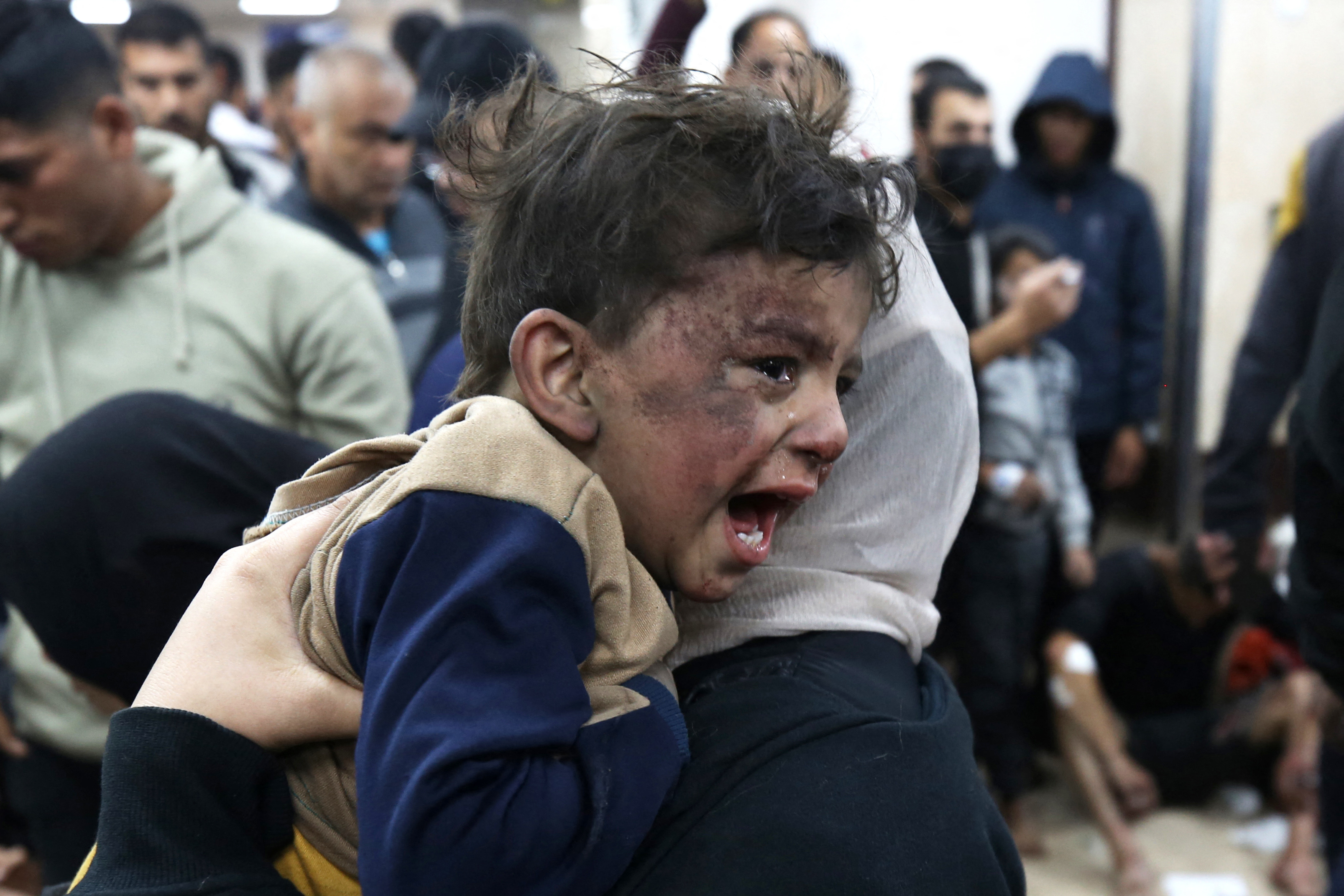 Palestinians injured following Israeli strikes on al-Maghazi refugee camp receive care at Al-Aqsa hospital in Deir Balah